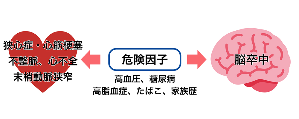 心臓・脳両方の病気の原因となるもの